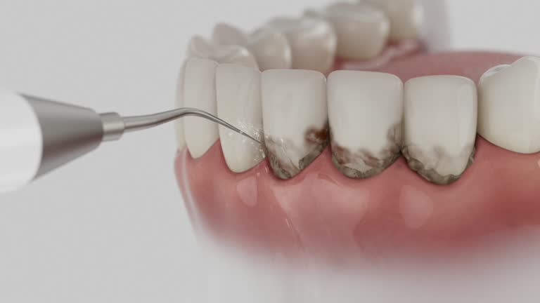 Reliable Dental Implants contractor in Orlovista, FL by Smile Center Dentistry